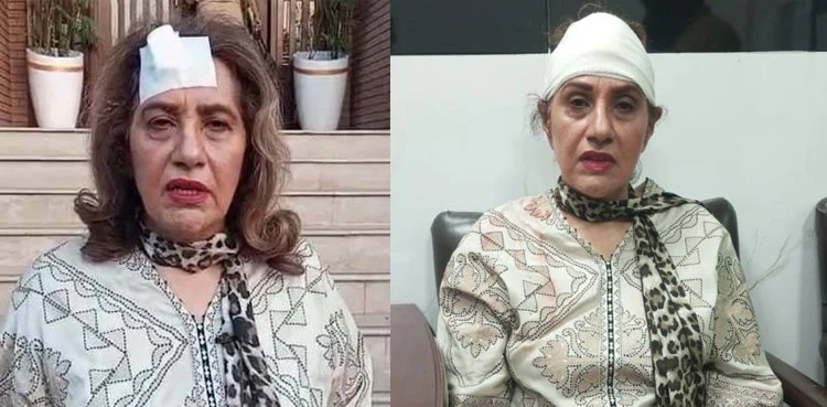 عظمی کردار جم میں ورزش کے دوران شدید زخمی